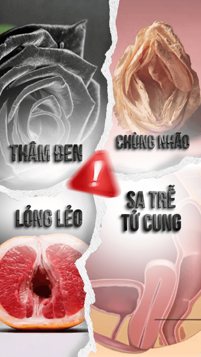 Lựa Chọn Nâng Cấp Vẻ Đẹp Cho Vùng Tiểu Eva 