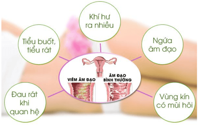 “Thủ phạm thầm lặng” khiến phụ nữ khó đậu thai: 80% chị em bỏ qua dấu hiệu này ở vùng kín